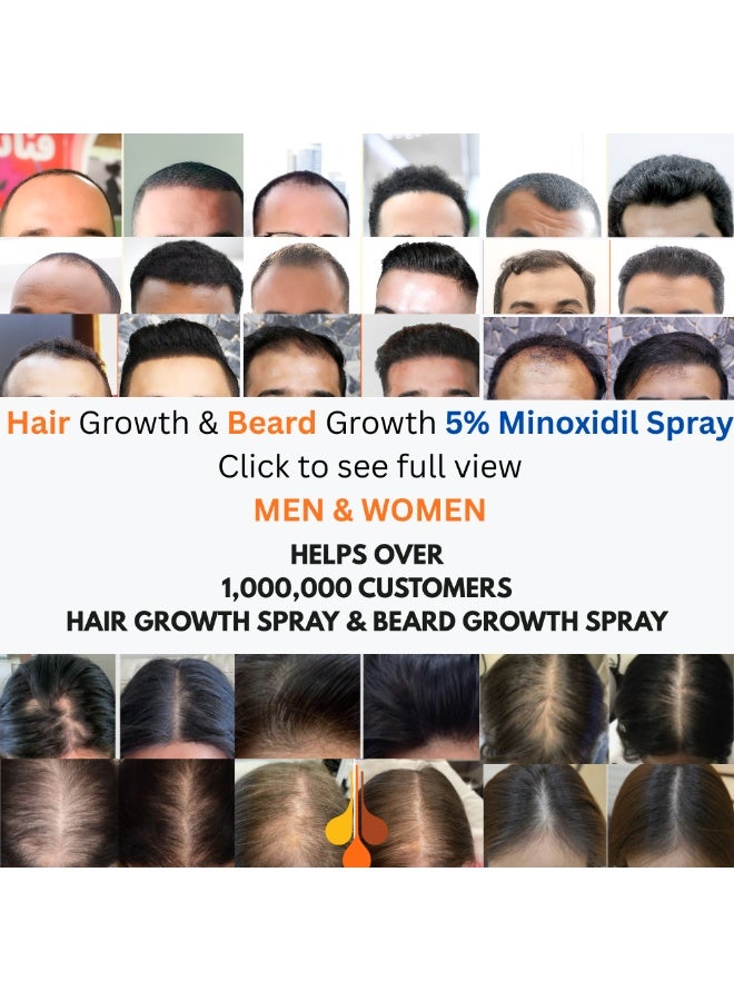 بادرا مينوكسيديل بتأثير ثلاثي – علاج نمو الشعر لمدة 4 أشهر | حل مثبت سريريًا لإعادة نمو الشعر - Image 2